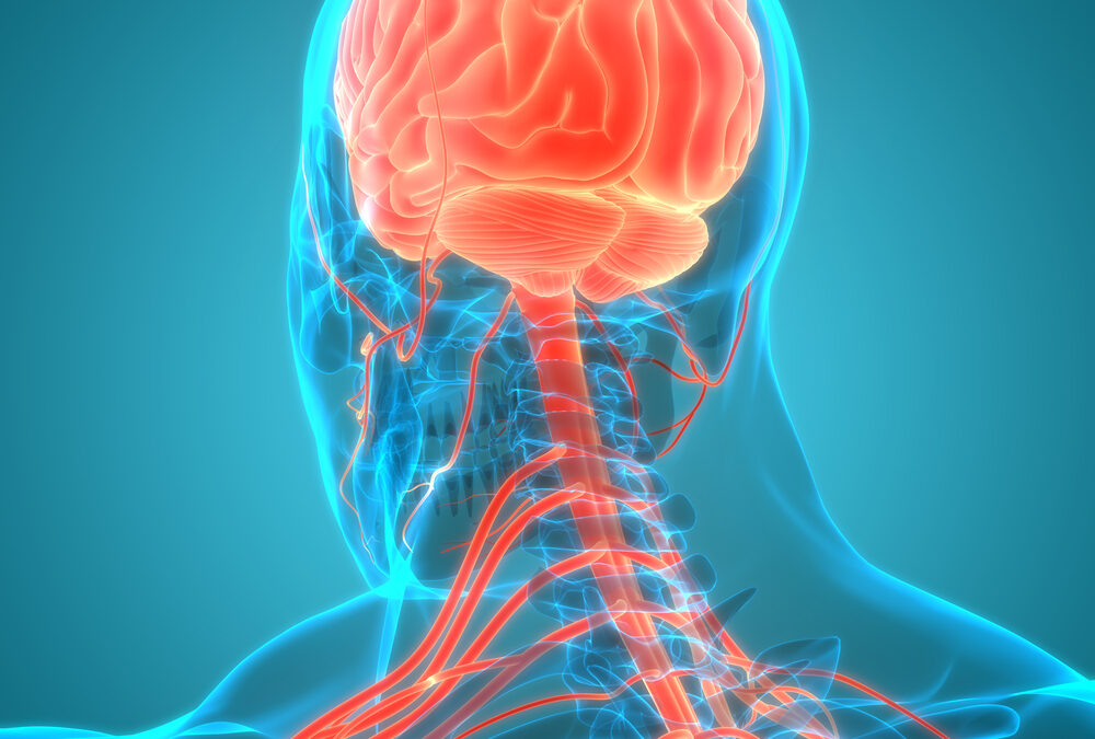 Strokes and Vascular Dementia